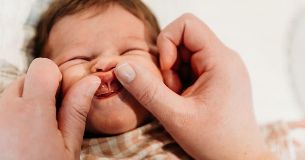 Postpartum Doula shows baby's upper lip