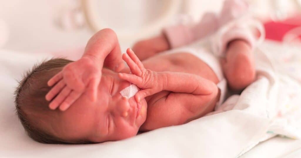 NICU baby lays down with breathing tube