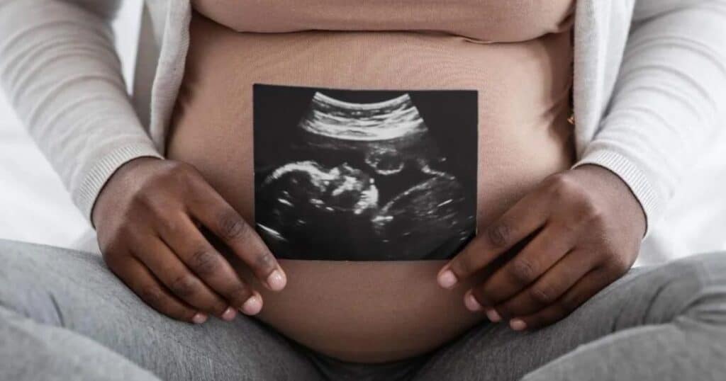 Pregnant woman holding an ultrasound photo.