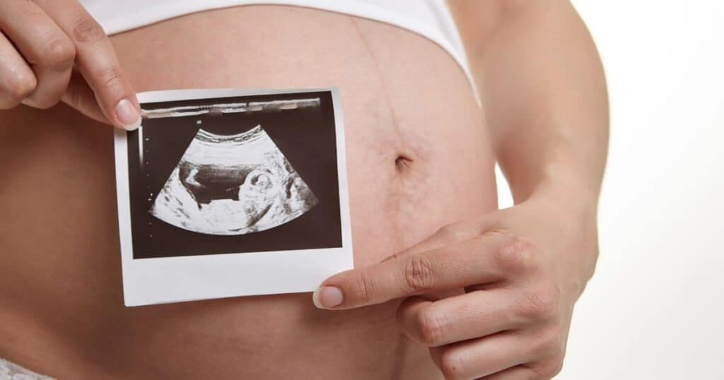 Pregnant woman holding ultrasound picture